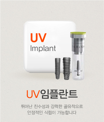 UVöƮ